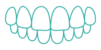 Overbite