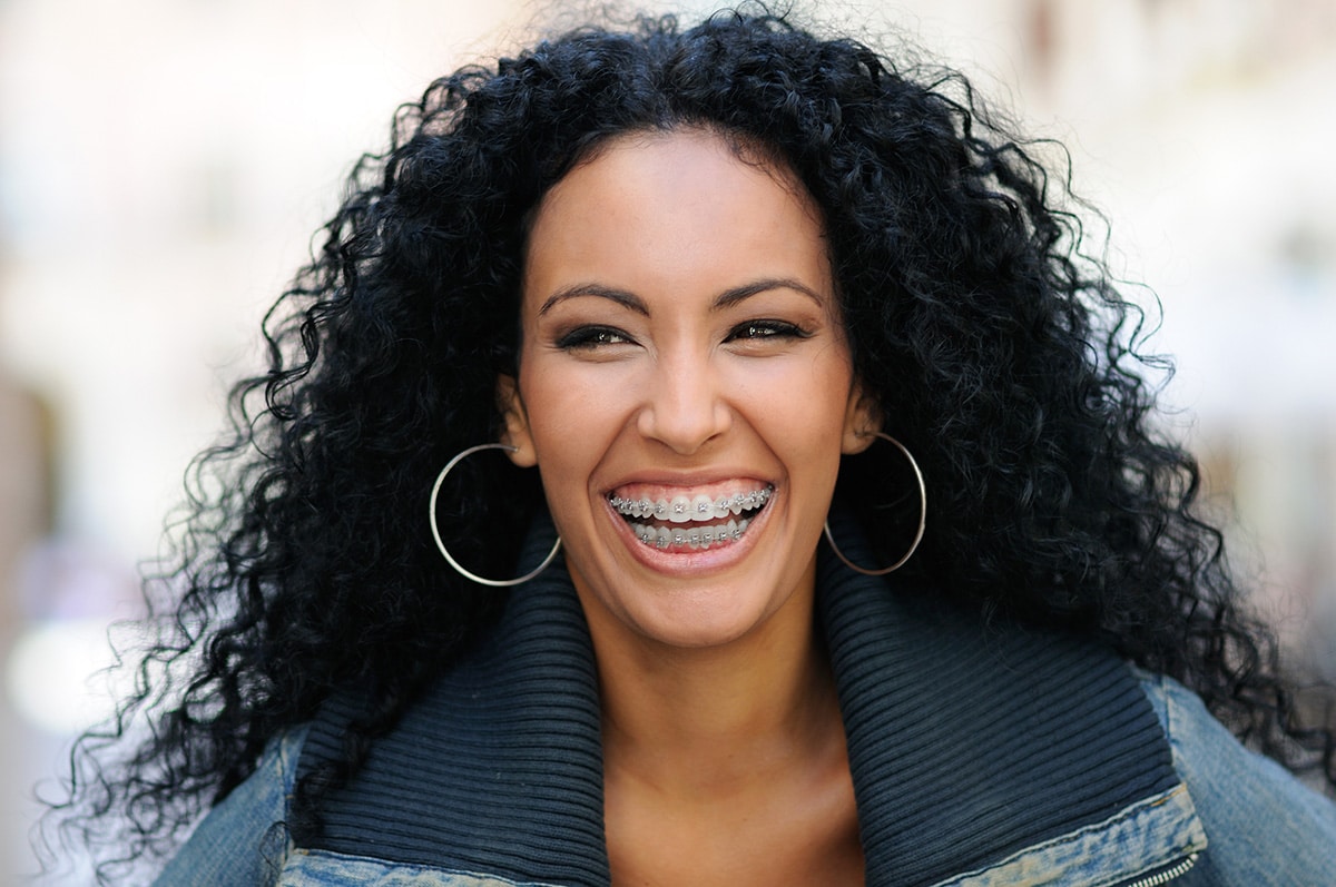 Braces for adults in Waterdown
